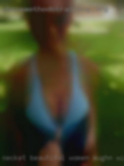 Necket beautiful women with veins Stoughton, WI.